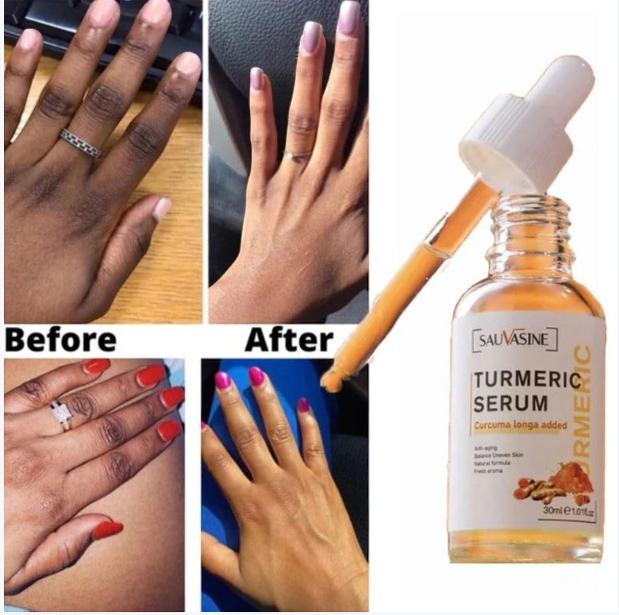 JHATPAT Beauty Lights Turmeric Serum for brightening and anti-blemish skin repair, showing before and after results.